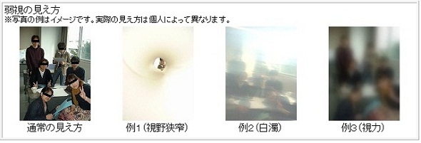 結膜炎とものもらい